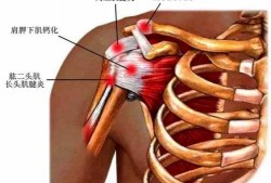 肩关节酸痛是什么原因
