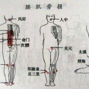 腰肌在身体的哪个位置-腰肌在身体什么位置