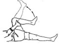 做不了屈膝的动作是为什么_不能做屈伸运动的关节是什么关节