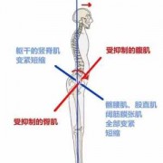腰椎超伸受限什么意思,腰椎超伸是什么意思 