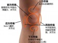 膝盖弯曲时不平是什么原因导致的 膝盖弯曲时不平是什么原因