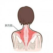 背部斜方肌疼-中背斜方肌疼痛是什么