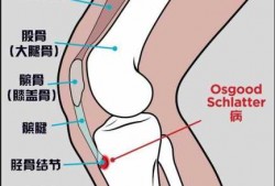  胫骨外侧肌肉是什么「胫骨外侧肌肉是什么部位」