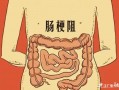 如何保护肠子 如何打印肠子条