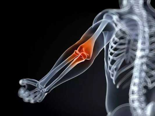 肘关节痛是什么原因,左手肘关节疼痛什么原因  第3张